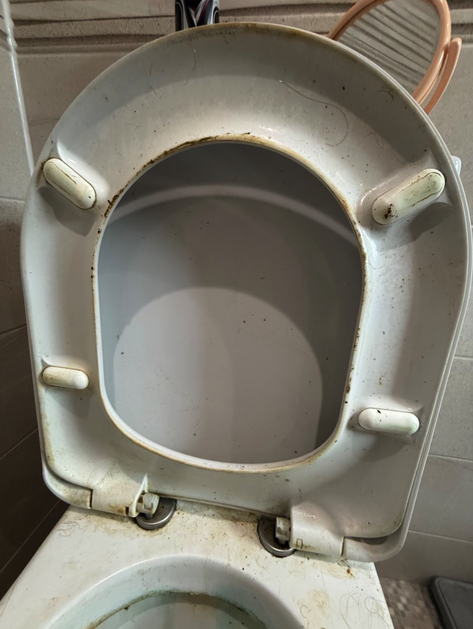 Toilet before cleaning — stained and dirty